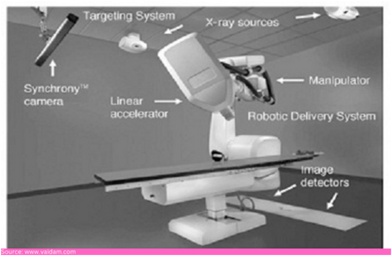 CyberKnife treatment 