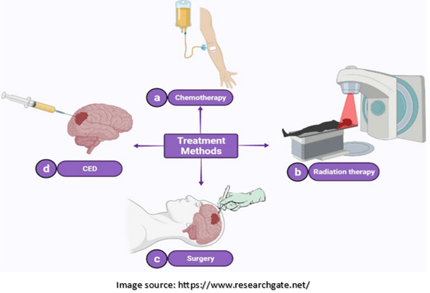 Treatment methods for Brain Tumor | Dr. Sridhar PS