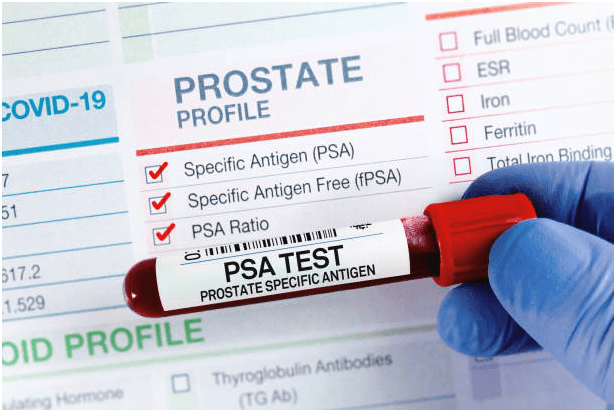 Prostate cancer diagnosis 
