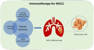 lung-cancer-treatment