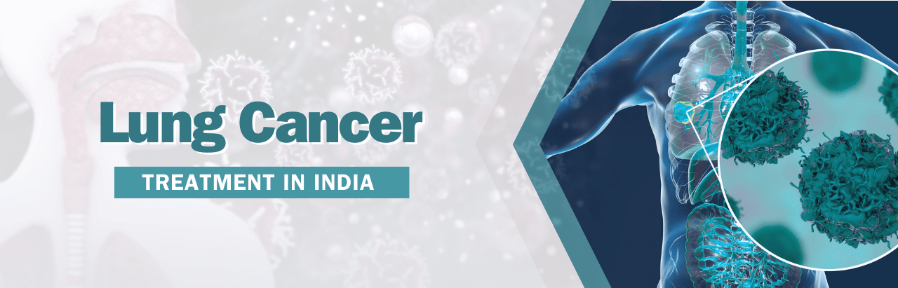 Lung Cancer Treatment in India | Dr. Sridhar P S