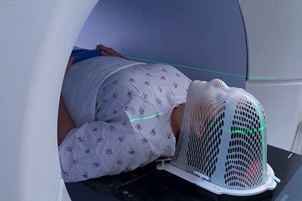 Radiating Resilience Radiation Therapy Procedure